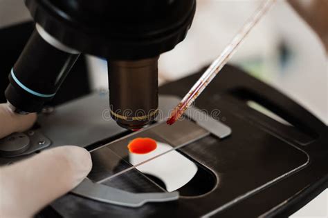 laboratory blood analysis|laboratory blood analysis equipment.